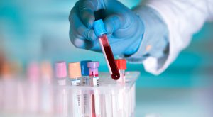 Xét nghiệm chức năng đông máu là các xét nghiệm đông máu tương ứng với quá trình hình thành đông máu.
