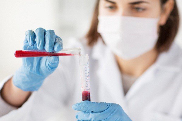 Xét nghiệm sinh hóa máu giúp định lượng và định tính các chất tồn tại trong máu